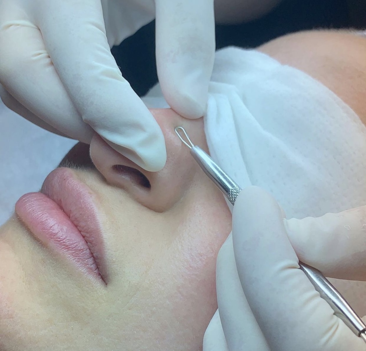 Custom facial at med spa in Dallas, TX