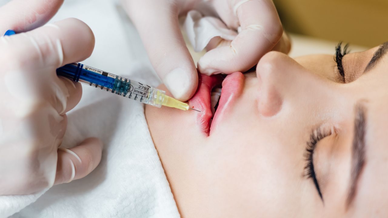 a young woman getting lip fillers in Texas