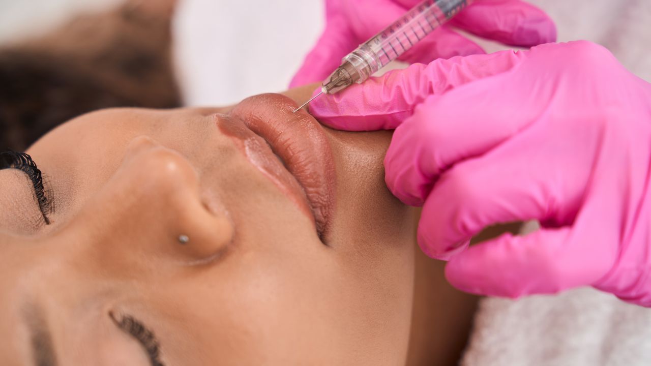lip fillers