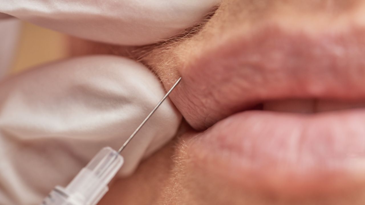 lip injection