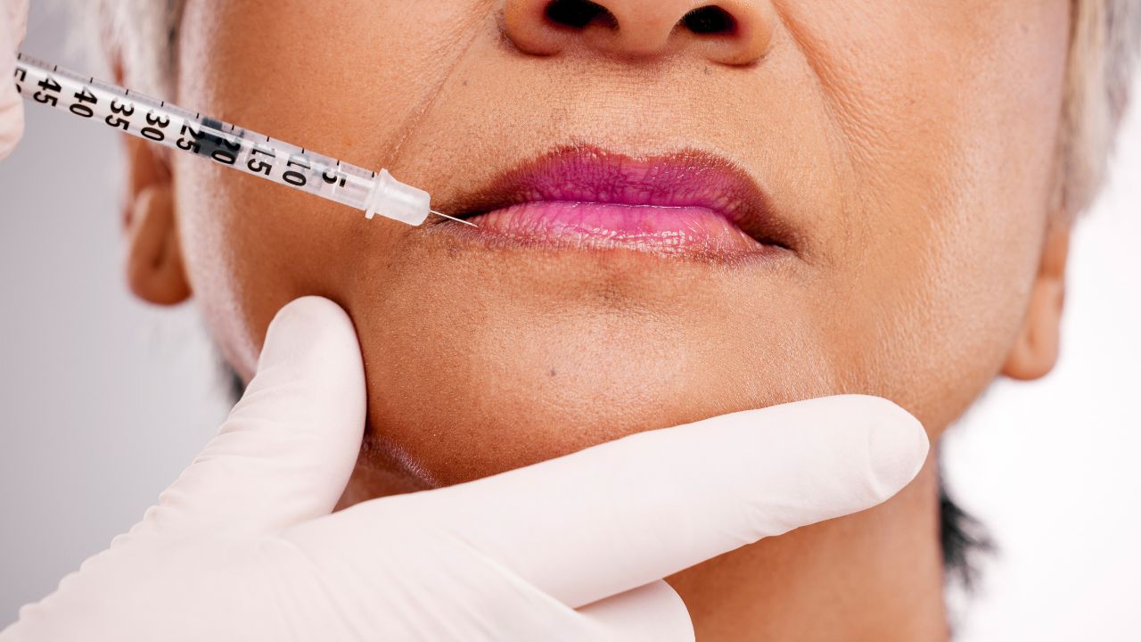 a woman getting long lasting lip filler